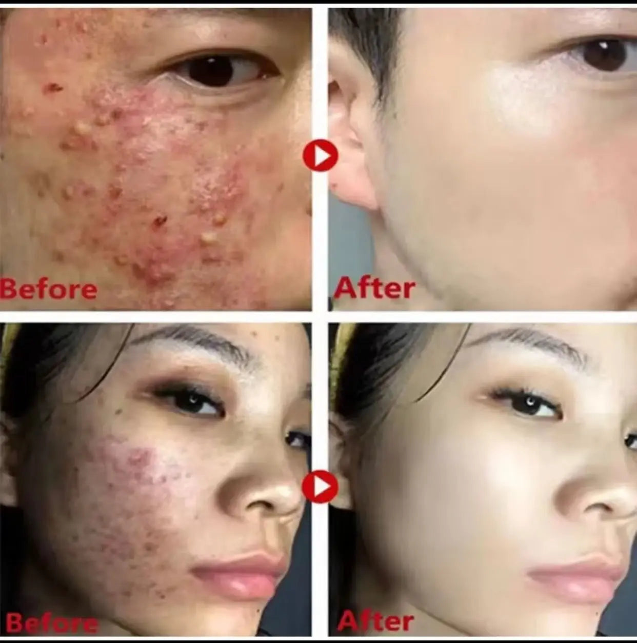 Gree Mask pour visage - FoutaShop